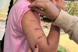 Nữ sinh lớp 5 ở Cà Mau bị người thân dùng dao cắt giấy gây thương tích