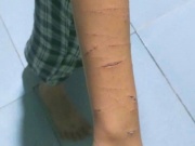 Chỉ đạo xử lý vụ học sinh lớp 5 bị chị họ dùng dao rạch nhiều lần tại Cà Mau