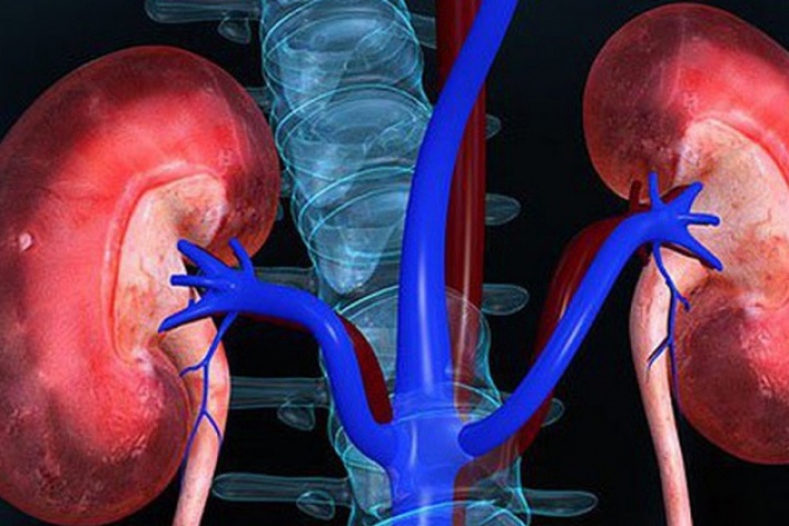8 dấu hiệu bệnh suy thận, người Việt cần biết để phòng bệnh từ sớm