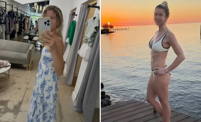 Daphne 'biến đổi' ngoạn mục nhờ công nghệ tiêm mỡ AlloClae. Ảnh: NY Post