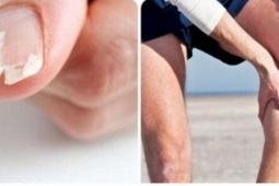 Dấu hiệu cảnh báo cơ thể đang thiếu canxi hay bị nhiều người bỏ qua