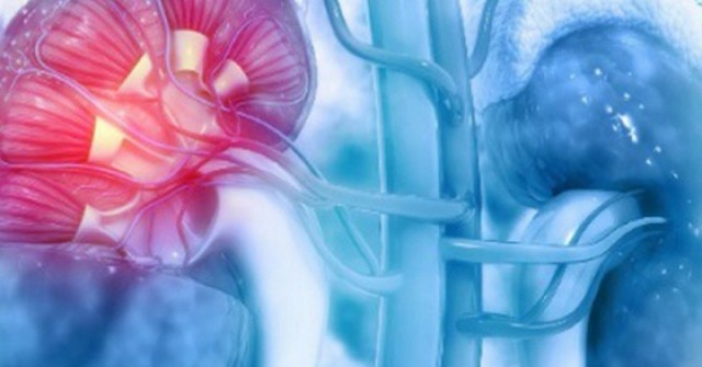 Cô gái 28 tuổi đối diện nguy cơ suy thận từ sai lầm trong lúc giảm cân nhiều người Việt mắc phải