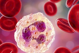 Tế bào ung thư 'thích' gì trong cơ thể bạn? người Việt hiểu đúng để phòng ngừa và điều trị hiệu quả