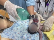 Đẻ rớt tại nhà, thay vì gọi 115, người nhà gọi xe công nghệ, em bé không qua khỏi
