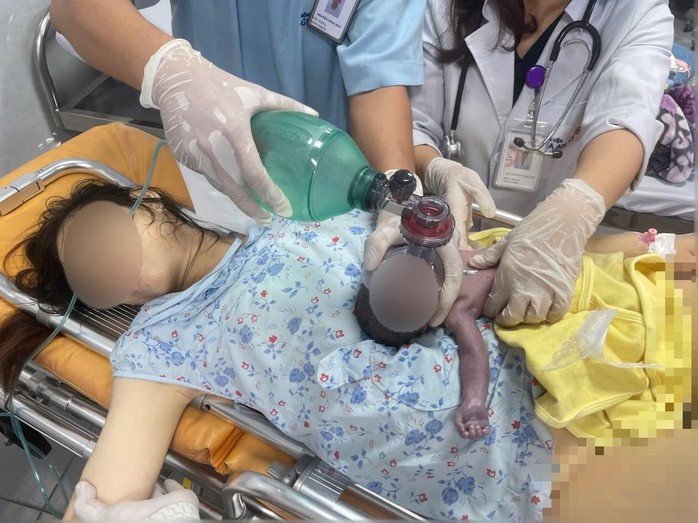 Thai phụ mang thai 28 tuần tuổi, đau bụng nhưng không đến bệnh viện, đẻ rớt tại nhà (Ảnh bác sĩ cung cấp)