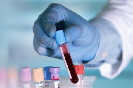 Xét nghiệm ung thư mới từ Mỹ có thể cứu nhiều người