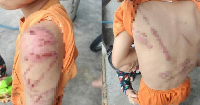 Xót xa hình ảnh cháu trai nghi bị cha đánh bầm ...