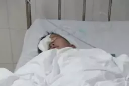 Xác minh vụ phụ huynh tố con học lớp 1 bị bạn chọc trúng mắt, rách giác mạc