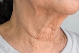 Hai vùng da 'tố cáo' tuổi tác rõ hơn gương mặt