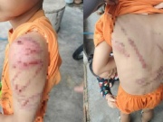 Xót xa hình ảnh cháu trai nghi bị cha đánh bầm tím khắp người