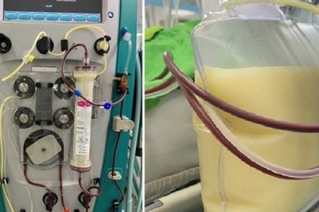 Nam sinh viêm tụy cấp, mỡ máu cao gấp 47 lần thừa nhận một sai lầm nhiều bạn trẻ Việt mắc phải