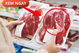 Tin tức sức khỏe - 5 loại thực phẩm cực hại cho tuyến tiền liệt của phái mạnh, nhiều người vẫn vô tư ăn mỗi ngày