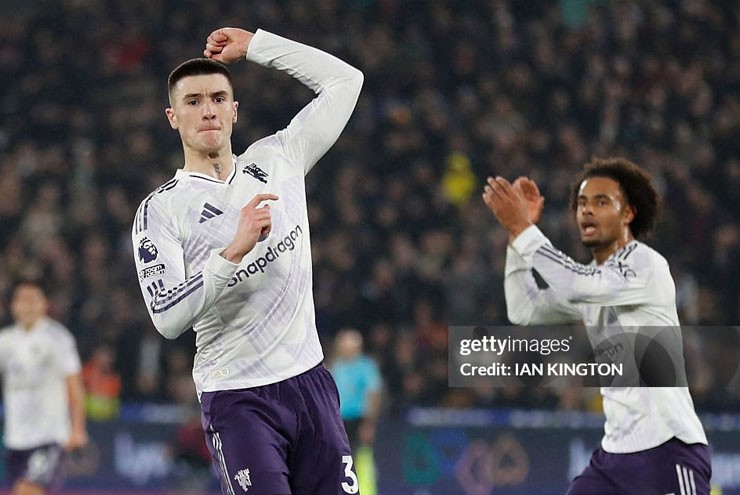 Sesko giật về điểm số cho MU