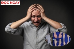 Tin tức sức khỏe - Đừng bỏ qua: 3 biểu hiện lạ ở người đau nhức xương khớp cảnh báo cơ thể đang suy kiệt