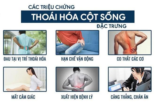 Các triệu chứng điển hình của bệnh lý ở cột sống