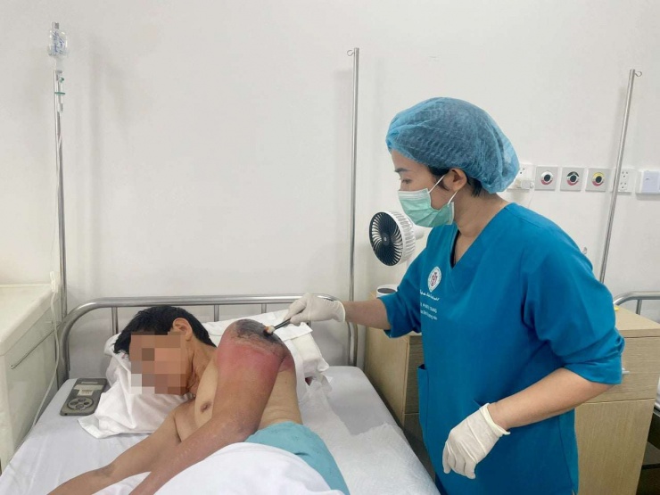 Điều dưỡng chăm sóc cho bệnh nhân H tại Khoa Bệnh lây đường máu. Ảnh BVCC