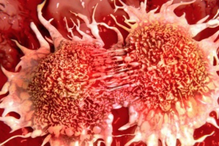 Thói quen dịp Tết tưởng tốt nhưng đang 'nuôi lớn' tế bào ung thư, người Việt ai mắc nên sớm từ bỏ