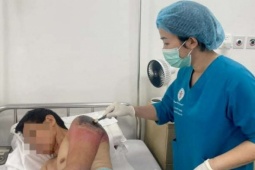 Tự ý đắp lá chữa chấn thương vai, người đàn ông phải nhập viện với nỗi hối hận