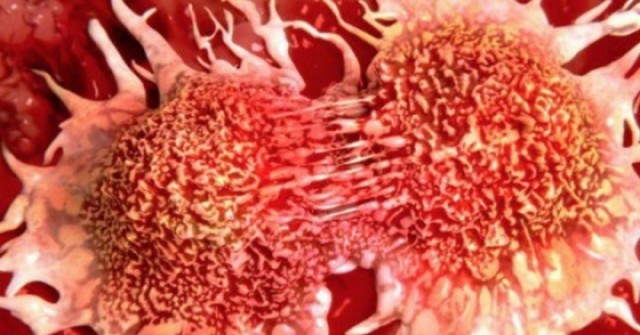 Thói quen dịp Tết tưởng tốt nhưng đang "nuôi lớn" tế bào ung thư, người Việt ai mắc nên sớm từ bỏ