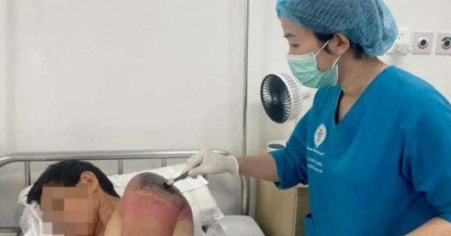 Tự ý đắp lá chữa chấn thương vai, người đàn ông phải nhập viện với nỗi hối hận