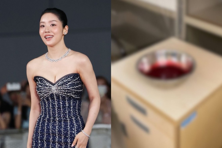 Tình trạng chảy máu mũi nghiêm trọng của Cha Joo Young.