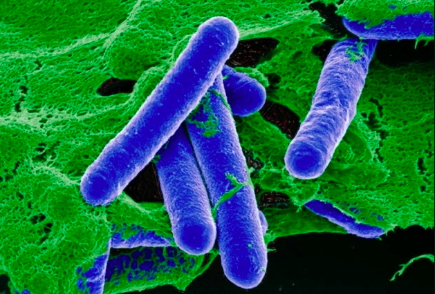 Vi khuẩn hình que sinh botulinum là độc tố kịch độc, có thể gây tử vong chỉ với lượng nhỏ. Ảnh:Nature