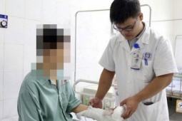 Tai nạn pháo nổ dịp Tết: Nhiều ca dập nát bàn tay, bác sĩ cảnh báo khẩn