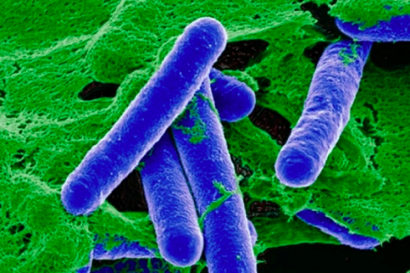 Bộ Y tế cảnh báo độc tố 'hủy hoại thần kinh' trong đồ ủ chua, đóng hộp