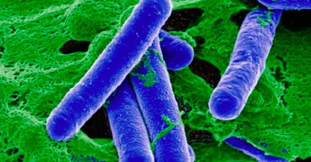 Bộ Y tế cảnh báo độc tố "hủy hoại thần kinh" trong đồ ủ chua, đóng hộp