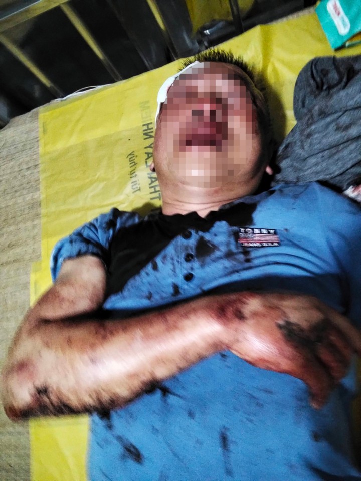 Ông Khương bị thương tích, xây xát nhiều nơi trên cơ thể sau khi bị nhóm côn đồ hành hung dã man.