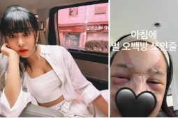Lời cảnh báo sau vụ MC xinh đẹp sưng vù mặt mũi vì phẫu thuật làm đẹp đón Tết