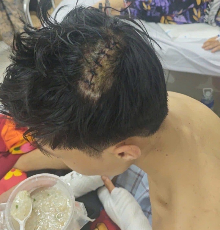 Tin mới vụ nhóm đối tượng đuổi chém, cướp tài sản của người đang về quê ăn Tết - 1