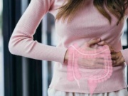 5 thay đổi lối sống ngăn polyp đại tràng tiến triển thành tế bào ung thư