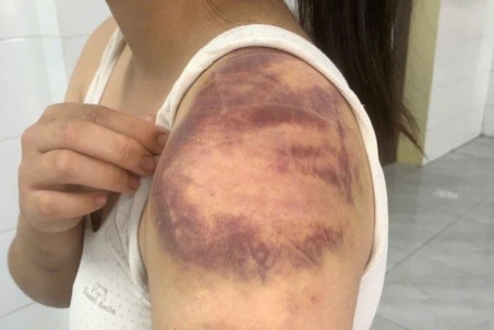 Người đàn ông nhiều lần trói, đánh đập con, vợ đang mang thai trong ngày Tết