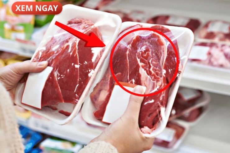 5 loại thực phẩm cực hại cho tuyến tiền liệt của phái mạnh, nhiều người vẫn vô tư ăn mỗi ngày