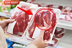 Tin tức sức khỏe - 5 loại thực phẩm cực hại cho tuyến tiền liệt của phái mạnh, nhiều người vẫn vô tư ăn mỗi ngày