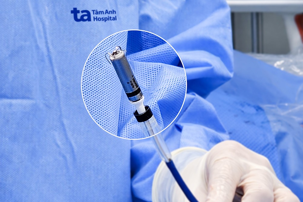 Máy tạo nhịp không dây thế hệ mới Micra AV2 có kích thước chỉ bằng viên thuốc hình con nhộng, nặng khoảng 2g. Ảnh: BVĐK Tâm Anh