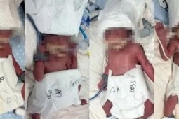 Sản phụ 24 tuổi sinh 5 con sau thụ thai tự nhiên