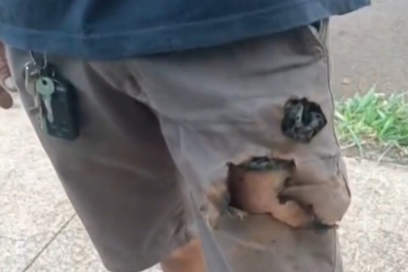 Điện thoại phát nổ cứu sống một người khỏi nanh vuốt chó dữ