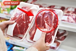 Tin tức sức khỏe - 5 loại thực phẩm cực hại cho tuyến tiền liệt của phái mạnh, nhiều người vẫn vô tư ăn mỗi ngày