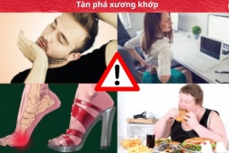 Tin tức sức khỏe - 5 thói quen “tàn phá” xương khớp - nên bỏ càng sớm càng tốt