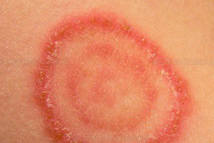 Cảnh giác nấm da lây từ chó, mèo