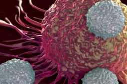 Người phụ nữ 58 tuổi phát hiện ung thư buồng trứng từ dấu hiệu nhiều chị em Việt bỏ qua