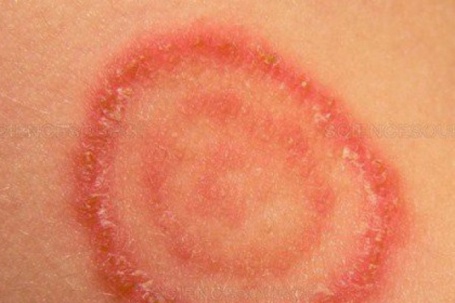 Cảnh giác nấm da lây từ chó, mèo