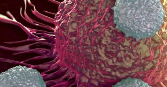 Người phụ nữ 58 tuổi phát hiện ung thư buồng trứng từ dấu hiệu nhiều chị em Việt bỏ qua