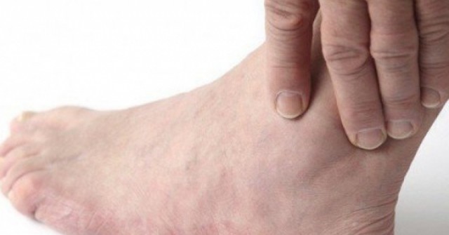 Sai lầm thường gặp chấn thương phần mềm cổ chân