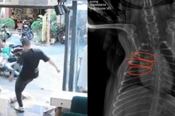 Clip du khách nước ngoài đá gãy xương chú chó ở Đà Nẵng khiến dân mạng phẫn nộ