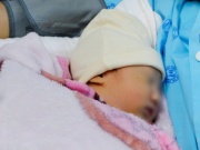 Thai phụ bị sốc phản vệ sau khi ăn ốc, ca mổ khẩn cứu 2 mẹ con