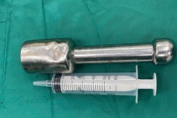 Nam sinh nhét chiếc chày 18 cm vào hậu môn