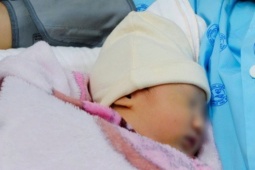 Thai phụ bị sốc phản vệ sau khi ăn ốc, ca mổ khẩn cứu 2 mẹ con